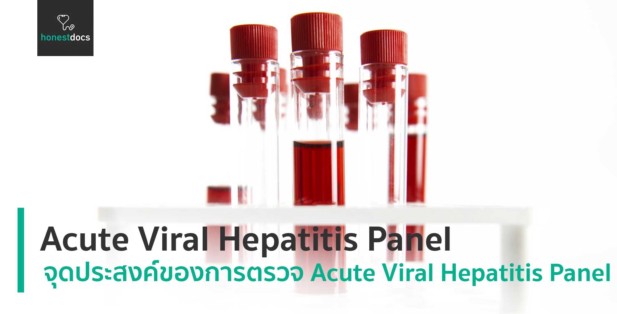 acute-viral-hepatitis-panel-hd