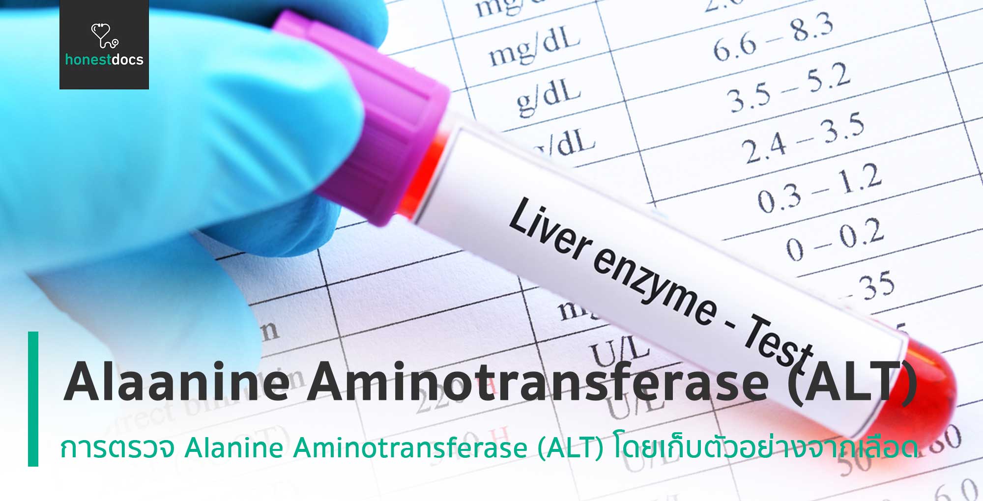 alt-alanine-aminotransferase-hd