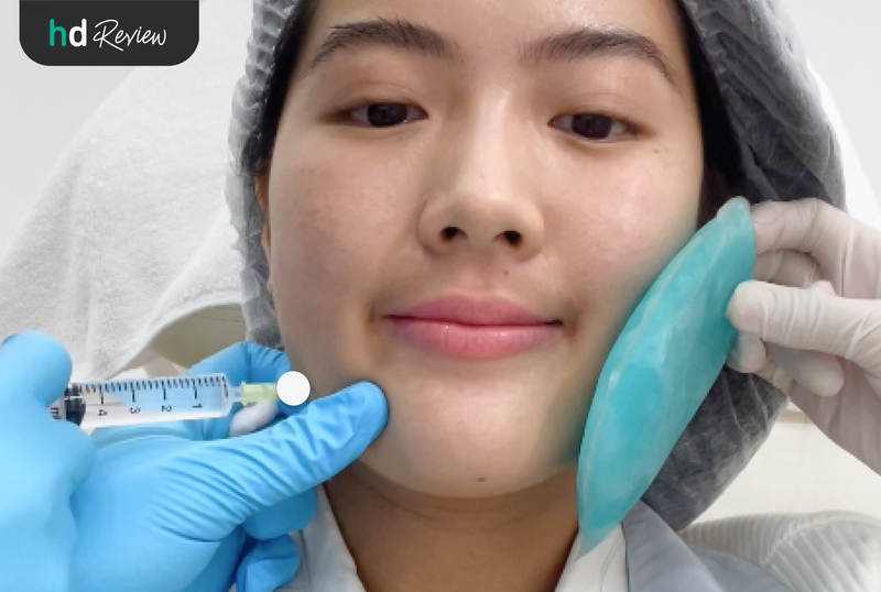 ฉีดแฟตที่ Ssense Clinic By Dr.Veeravit