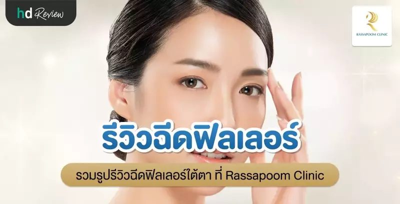 รีวิวฉีดฟิลเลอร์ใต้ตา ที่ Rassapoom Clinic