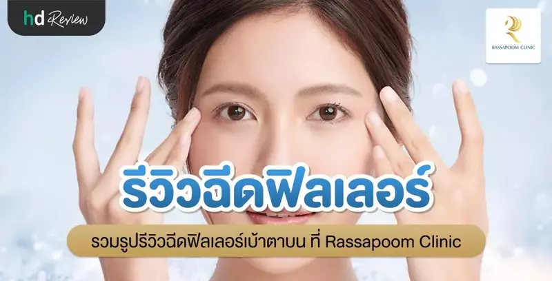 รีวิวฉีดฟิลเลอร์เบ้าตาบน ที่ Rassapoom Clinic