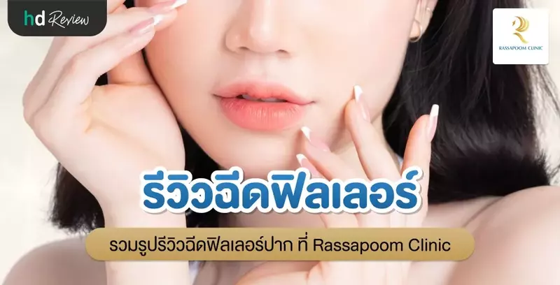 รีวิวฉีดฟิลเลอร์ปาก ที่ Rassapoom Clinic