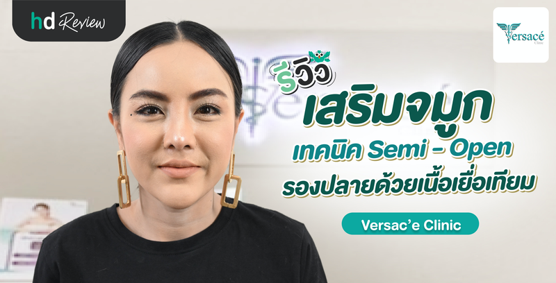 รีวิวเสริมจมูกเทคนิค Semi-Open รองปลายด้วยเนื้อเยื่อเทียม ที่ Versac’e Clinic