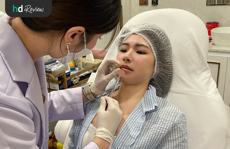 ขั้นตอนการฉีดฟิลเลอร์ปาก Restylane Kysse