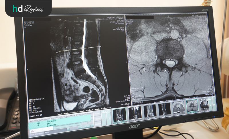 ผลตรวจ MRI หลังที่ รพ.พญาไท 1
