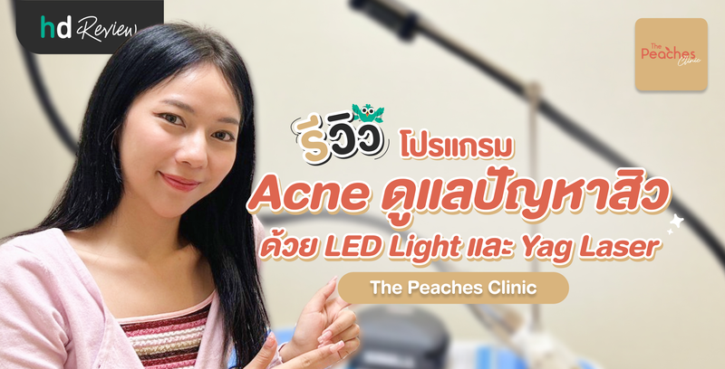 รีวิวโปรแกรม Acne ดูแลปัญหาสิว ด้วย LED Light และ Yag Laser ที่ The Peaches Clinic