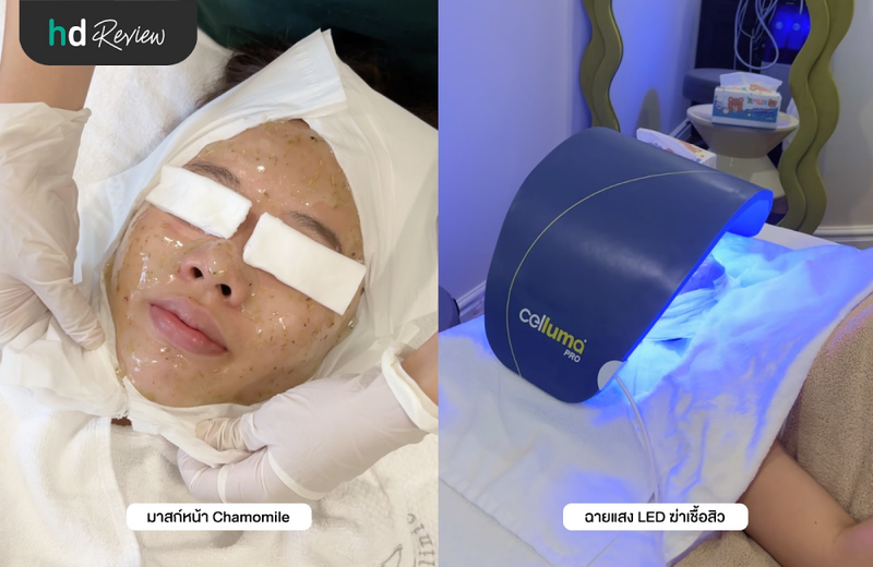 บำรุงผิวหน้าจากสิว ที่ Muse Clinic